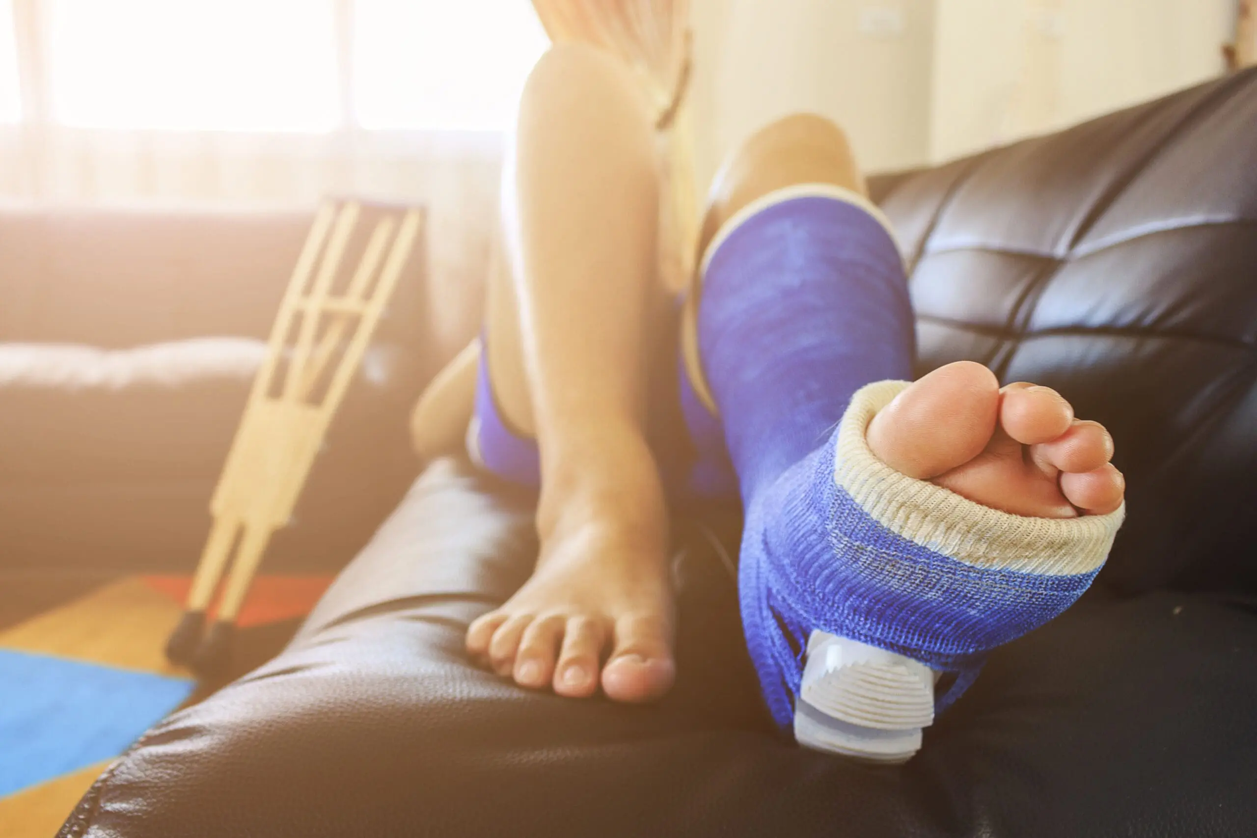 broken leg in a plaster cast with soft-focus in the background